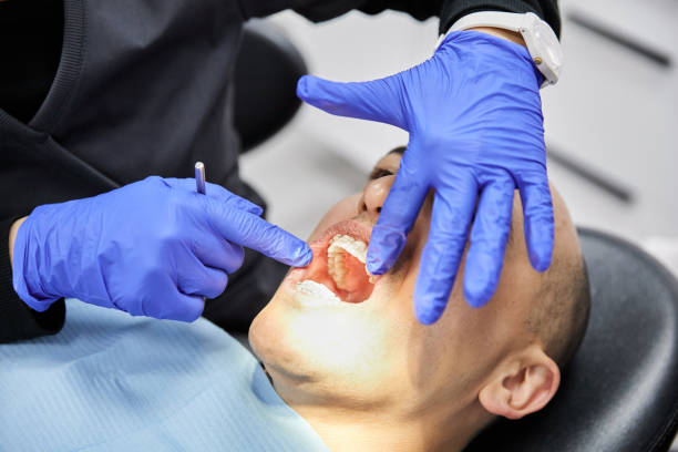 Best Dentist for Tooth Abscess  in Burbank, IL